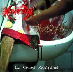 Hematoma (MEX) : La Cruel Realidad